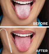 image de contenu aplus